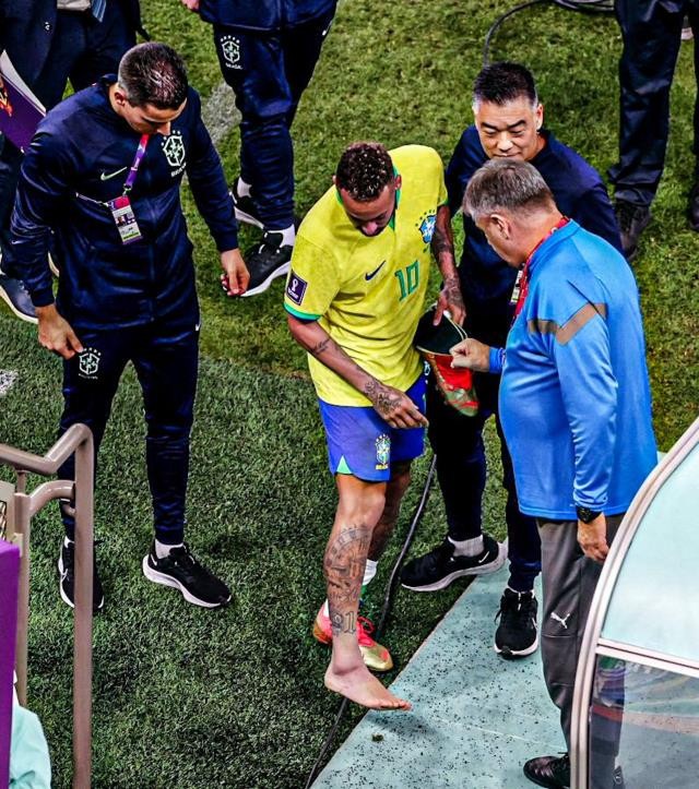 Dünya Kupası defterini kapatabilir! Sakatlanan Neymar'ın ayağının son hali olay oldu - Resim : 1