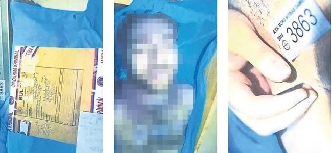 Cem Garipoğlu’nun otopsi görüntüleri ortaya çıktı! Bilirkişi incelemesi yapıldı… - Resim : 1